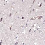 EML4 Antibody in Immunohistochemistry (IHC)