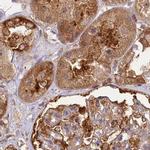 EML4 Antibody in Immunohistochemistry (IHC)