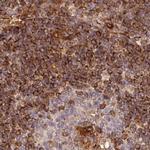 EML4 Antibody in Immunohistochemistry (IHC)