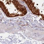 EML4 Antibody in Immunohistochemistry (IHC)