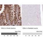 EML4 Antibody