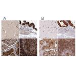 EML4 Antibody in Immunohistochemistry (IHC)