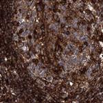 EML4 Antibody in Immunohistochemistry (IHC)