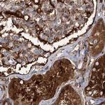 EML4 Antibody in Immunohistochemistry (IHC)