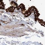 EML4 Antibody in Immunohistochemistry (IHC)