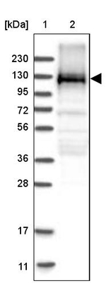 EML4 Antibody in Western Blot (WB)