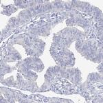 LZK Antibody in Immunohistochemistry (Paraffin) (IHC (P))