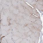 LZK Antibody in Immunohistochemistry (Paraffin) (IHC (P))