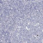 LZK Antibody in Immunohistochemistry (Paraffin) (IHC (P))