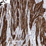 GTDC1 Antibody in Immunohistochemistry (Paraffin) (IHC (P))