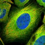 MAP4K5 Polyclonal Antibody