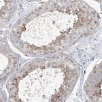 MAP4K5 Antibody in Immunohistochemistry (Paraffin) (IHC (P))