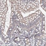 KIP2 Polyclonal Antibody