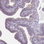 VWA3B Polyclonal Antibody