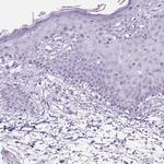 TFF2 Antibody in Immunohistochemistry (Paraffin) (IHC (P))