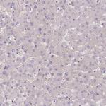 Adenylate Kinase 9 Antibody in Immunohistochemistry (IHC)