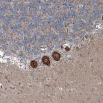 INTU Polyclonal Antibody