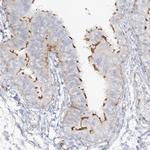 PPIL6 Antibody in Immunohistochemistry (Paraffin) (IHC (P))