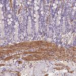 GPX8 Antibody in Immunohistochemistry (Paraffin) (IHC (P))