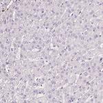 GPX8 Antibody in Immunohistochemistry (Paraffin) (IHC (P))