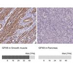 GPX8 Antibody in Immunohistochemistry (IHC)