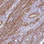 GPX8 Antibody in Immunohistochemistry (IHC)