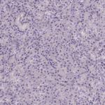 GPX8 Antibody in Immunohistochemistry (IHC)