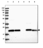 GPX8 Antibody in Western Blot (WB)