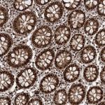 CWC22 Antibody in Immunohistochemistry (Paraffin) (IHC (P))