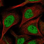 ARGBP2 Polyclonal Antibody