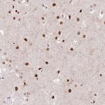 ARGBP2 Antibody in Immunohistochemistry (Paraffin) (IHC (P))