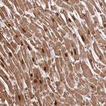 ARGBP2 Antibody in Immunohistochemistry (Paraffin) (IHC (P))