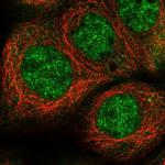 EPC2 Antibody in Immunocytochemistry (ICC/IF)