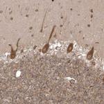 EPC2 Antibody in Immunohistochemistry (Paraffin) (IHC (P))