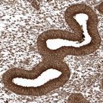 EPC2 Antibody in Immunohistochemistry (Paraffin) (IHC (P))