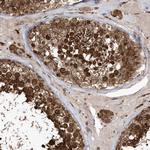 EPC2 Antibody in Immunohistochemistry (Paraffin) (IHC (P))