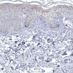 NIPAL1 Antibody in Immunohistochemistry (IHC)
