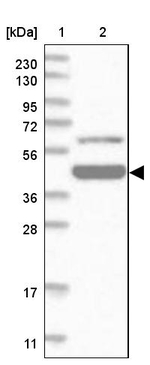 ZBTB9 Antibody in Western Blot (WB)