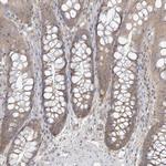 ANKS1 Antibody in Immunohistochemistry (Paraffin) (IHC (P))