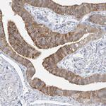 ANKS1 Antibody in Immunohistochemistry (Paraffin) (IHC (P))