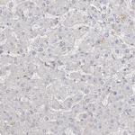 ANKS1 Antibody in Immunohistochemistry (Paraffin) (IHC (P))