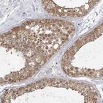 ANKS1 Antibody in Immunohistochemistry (Paraffin) (IHC (P))