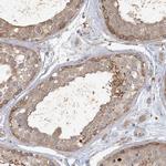 ANKS1 Polyclonal Antibody