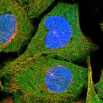 N4BP2 Antibody in Immunocytochemistry (ICC/IF)