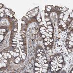 N4BP2 Antibody in Immunohistochemistry (Paraffin) (IHC (P))