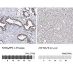ARHGAP6 Antibody