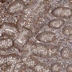 TTC7A Polyclonal Antibody