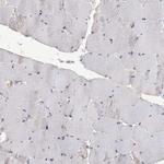 TTC7A Antibody in Immunohistochemistry (Paraffin) (IHC (P))