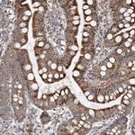 TTC7A Polyclonal Antibody