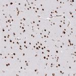 ZNF638 Antibody in Immunohistochemistry (Paraffin) (IHC (P))